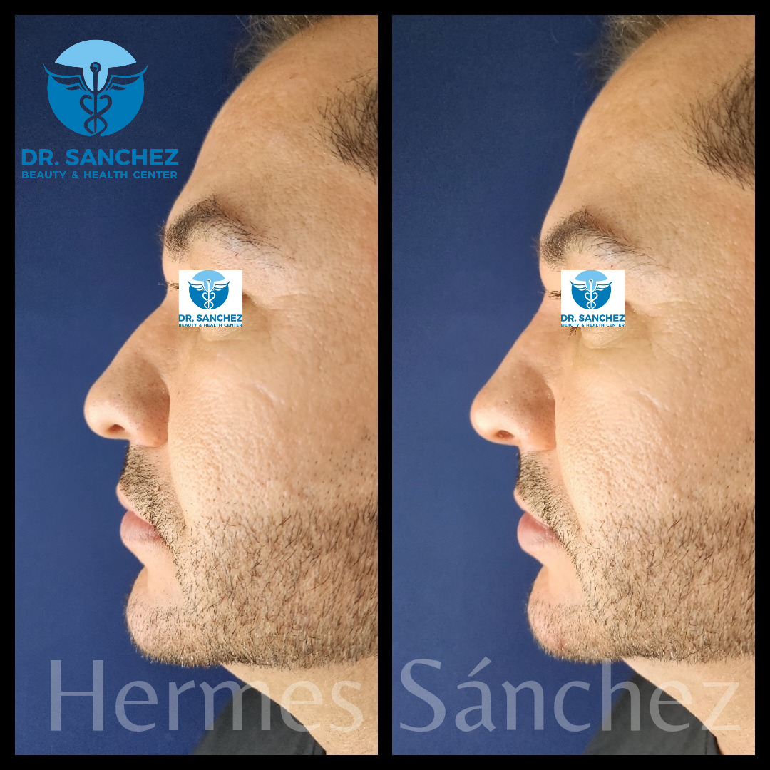 Galería - Transformación 11